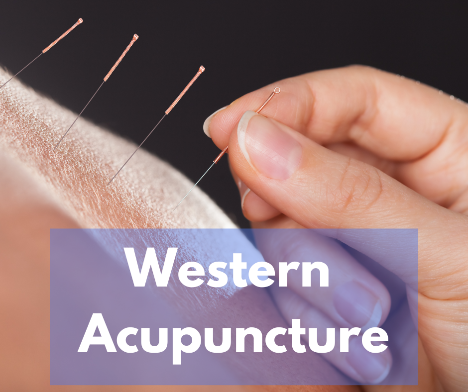 Western Acupuncture at Surrey Injury Clinic Horley